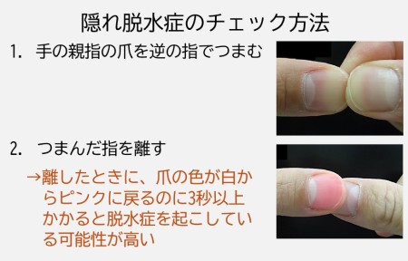 隠れ脱水症のチェック方法
